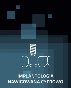 implantologia_cyfrowa