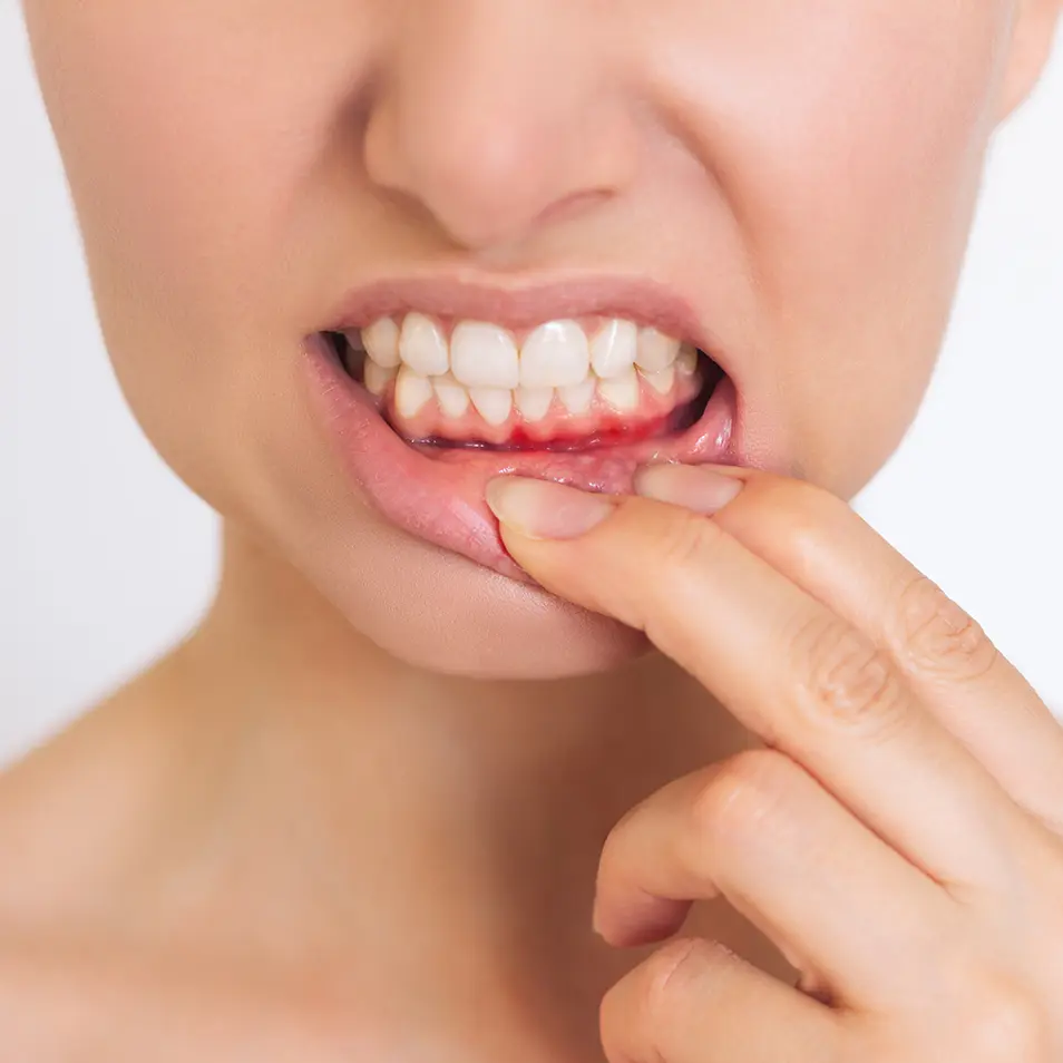 Periodontologia