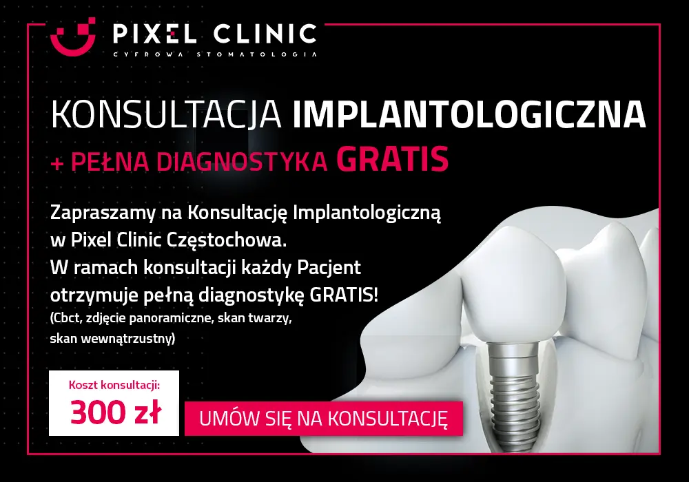 implantologia