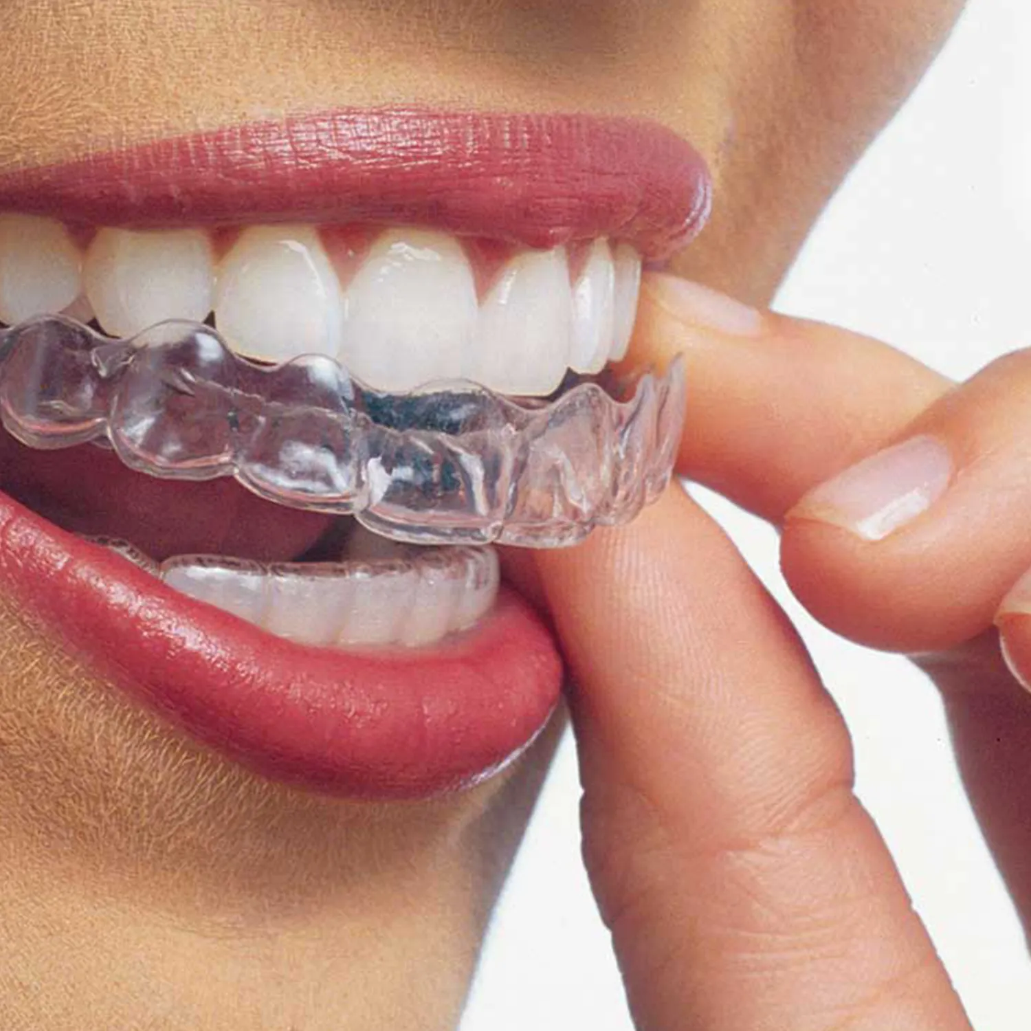 Invisalign Częstochowa