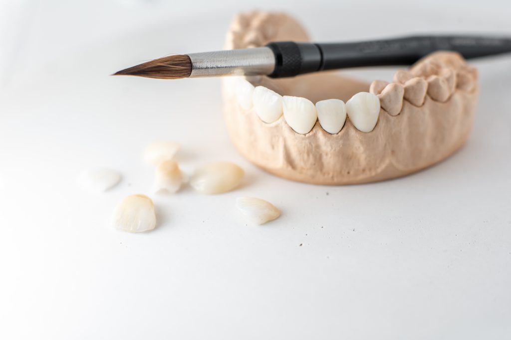 Model of artificial jaw with teeth